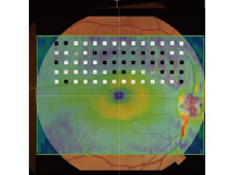 Fundus Oriented Perimetry