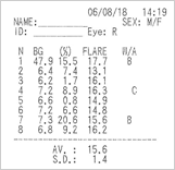 Photo : Working distance adjustment