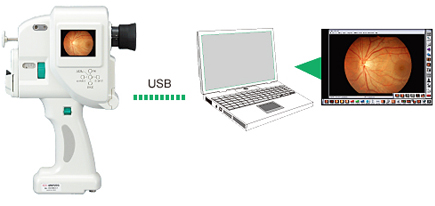 Options for more extended use